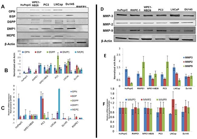 Western blot and quantitative RT-PCR analysis of SIBLING and MMP expression in normal and prostate cancer cell lines.