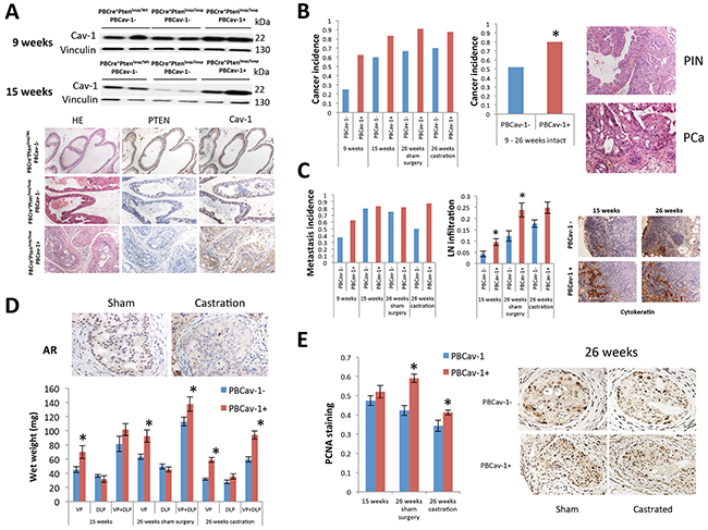 Cav-1 overexpression induced PCa development, enhanced growth, and promoted hormone resistance in PTENcKO tumors.