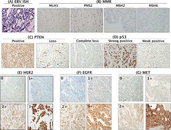 Representative positive images of multiple markers.