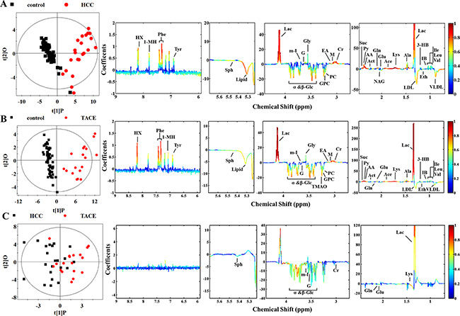 Scores and loading plots for determination of plasma metabolites responsible for the metabolic variations in different pair-wise pathological subjects via OPLS-DA analyses.