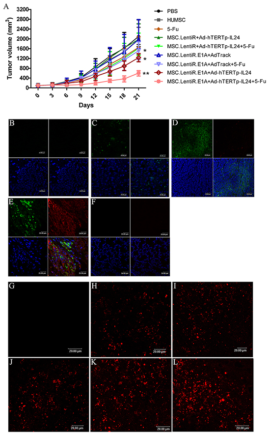 Tumor suppressing effects of Ad-hTERTp-IL24 loaded MSC.LentiR.E1A in combination with 5-Fu against HepG2 xenograft tumors.