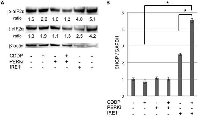 UPR production was increased in cancer stem-like cells treated with the IRE1&#x03B1; inhibitor combined with cisplatin.