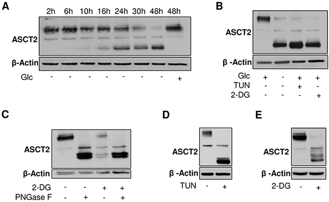 Glycosylation of ASCT2 is dependent on glucose availability.