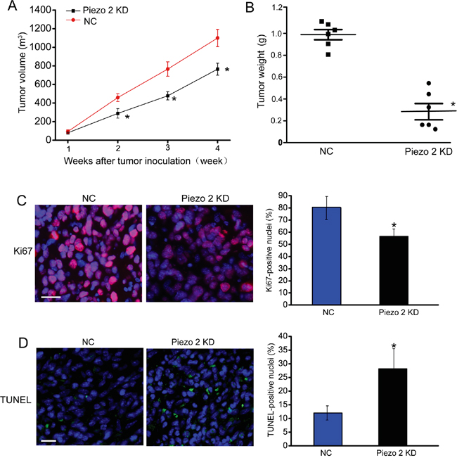 Piezo2 knockdown suppresses tumor growth.