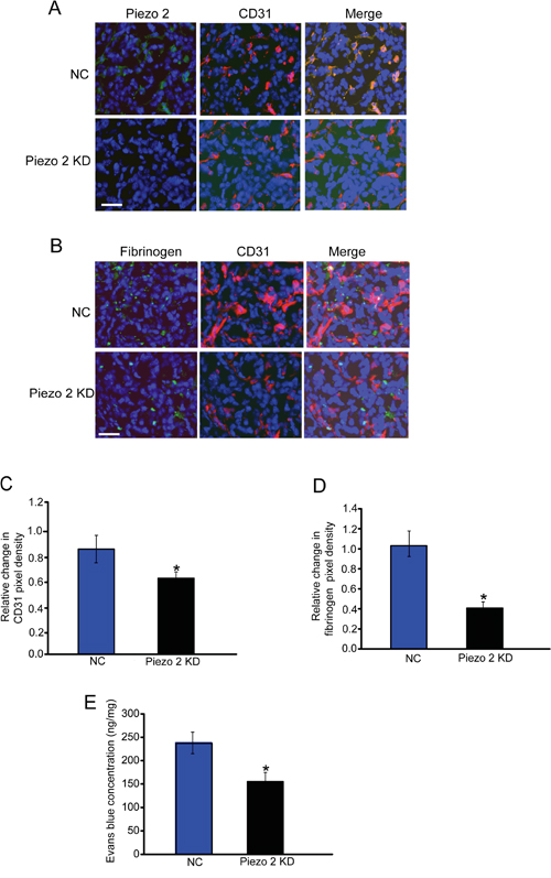 Piezo2 is localized in tumor endothelial cells, and regulates tumor angiogenesis and vascular leakage.