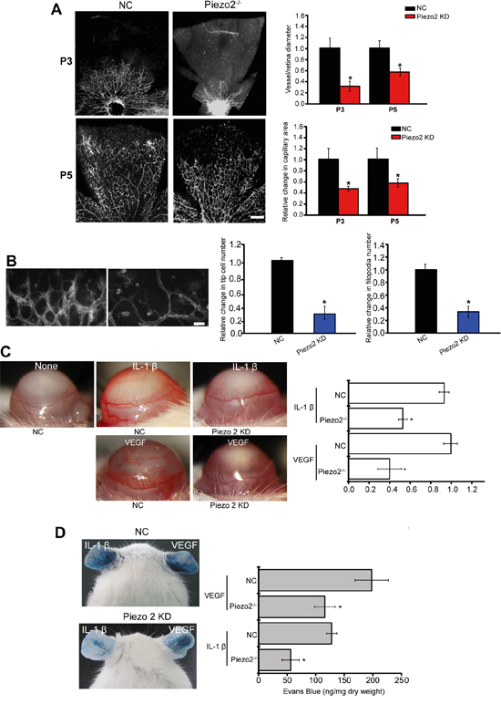 Piezo2 knockdown affects angiogenesis and vascular permeability in vivo.