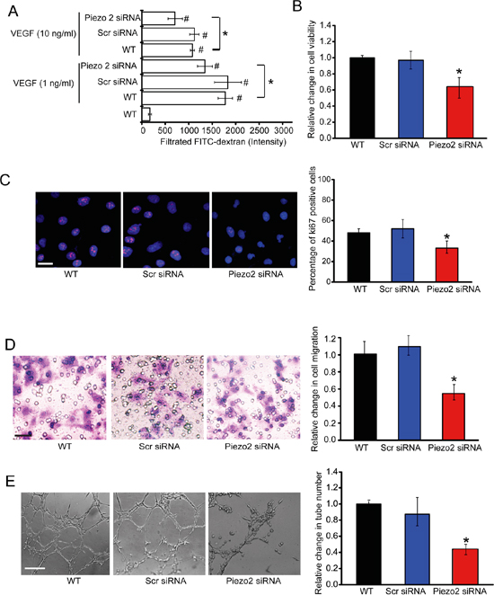Piezo2 knockdown affects endothelial cell and tumor cell function in vitro.