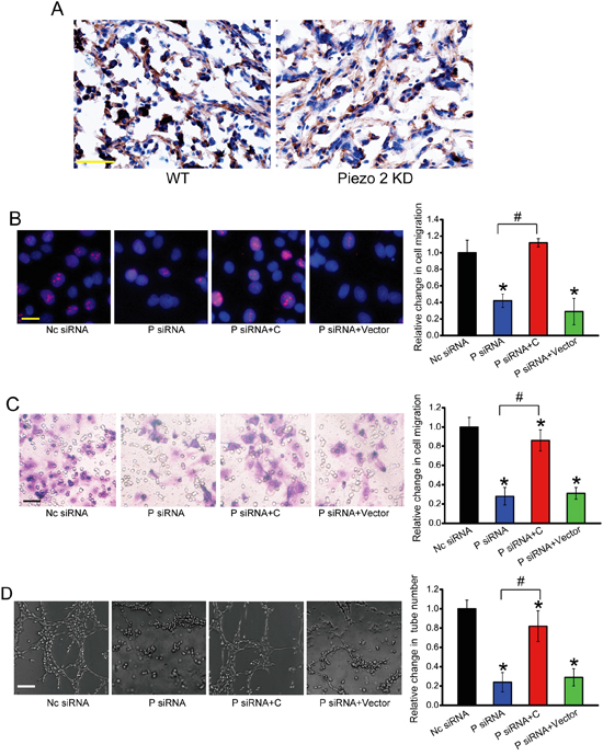Piezo2 regulates the angiogenic activity of endothelial cells via &#x03B2;-catenin signaling.