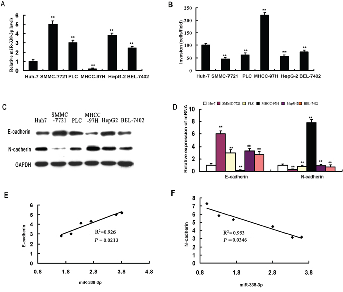 miR-338-3p expression levels correlate with invasive capacity and epithelial-mesenchymal transition (EMT) phenotype in hepatocellular carcinoma (HCC) cells.