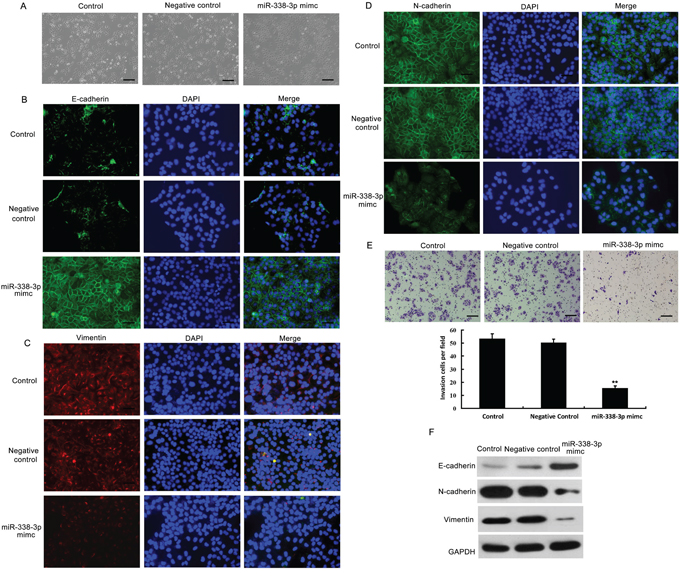 Effects of miR-338-3p overexpression on epithelial-mesenchymal transition (EMT) and invasiveness of hepatocellular carcinoma (HCC) cells.