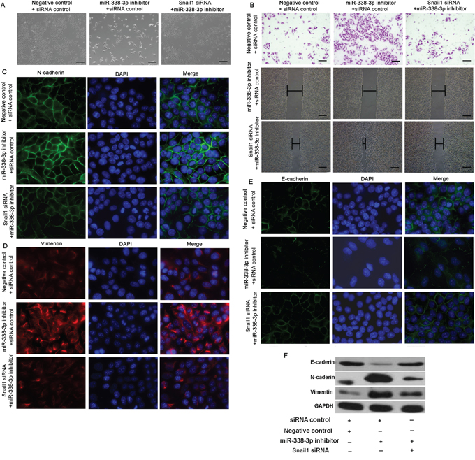Effect of Snail1 expression on miR-338-3p-induced epithelial-mesenchymal transition (EMT).