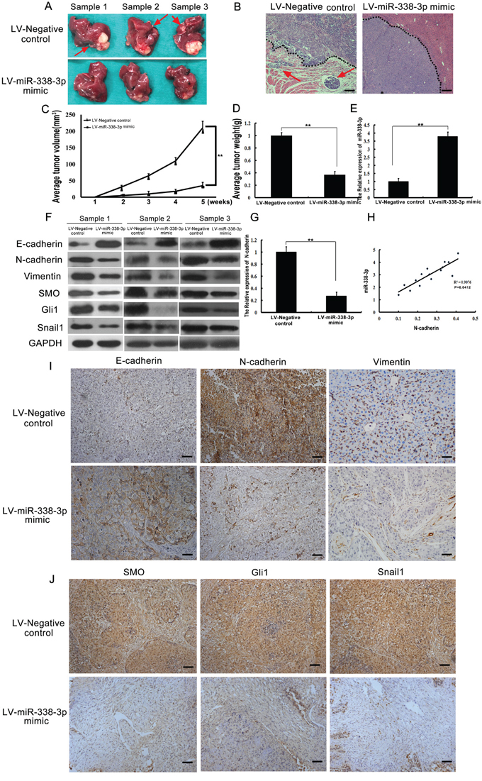 Analysis of miR-338-3p, Smoothened (SMO), Gli1, Snail1, E-cadherin, N-cadherin, and vimentin expression in an orthotopic xenograft hepatocellular carcinoma (HCC) model.