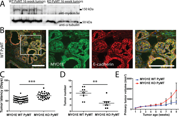 PyMT mice deficient in MYO1E exhibit increased tumor latency but faster increase in volume compared to the MYO1E WT PyMT controls.