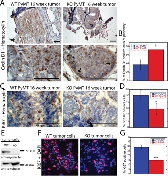 Loss of MYO1E expression delays tumor progression and reduces cell proliferation.