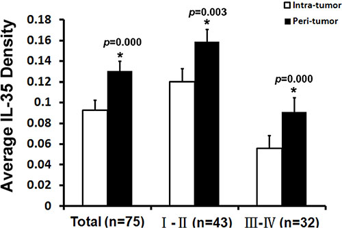 Average density of IL-35 staining in tumor tissue and peri-tumoral liver tissues.