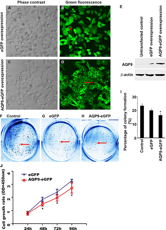 Overexpression of AQP9 in liver cancer cells inhibits cell proliferation.