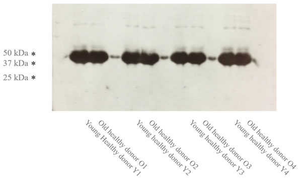 The Age-specific IL7R expression (