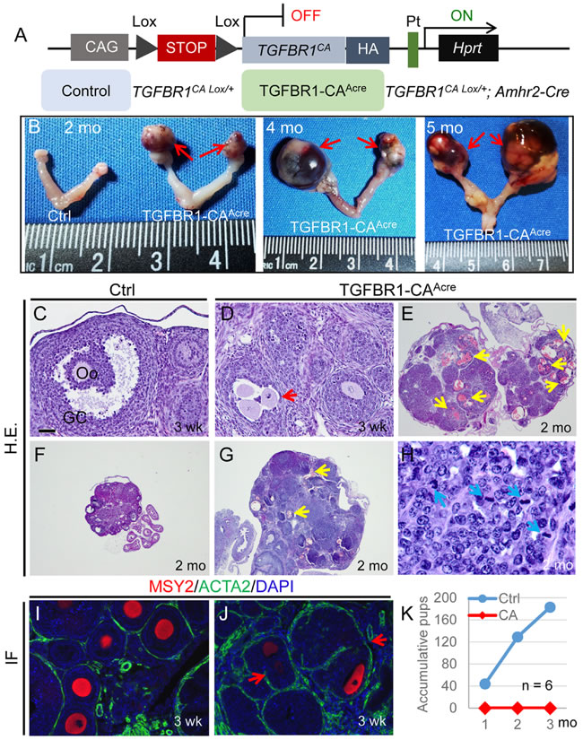 Constitutive activation of TGFBR1 in the mouse ovary using