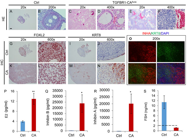 Histological, immunohistochemical, and hormonal analyses of ovarian tumors in TGFBR1-CA