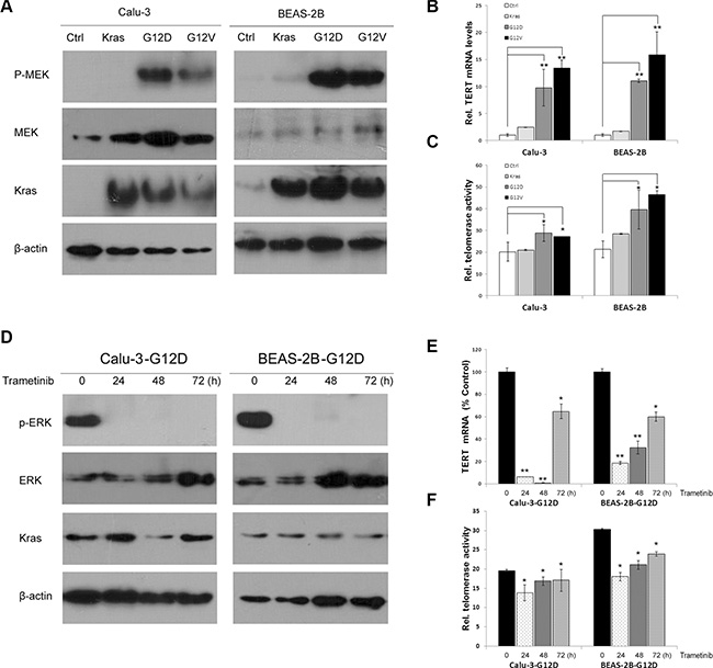 Kras mutations upregulate TERT expression and telomerase activities by the RAS-MEK pathway.