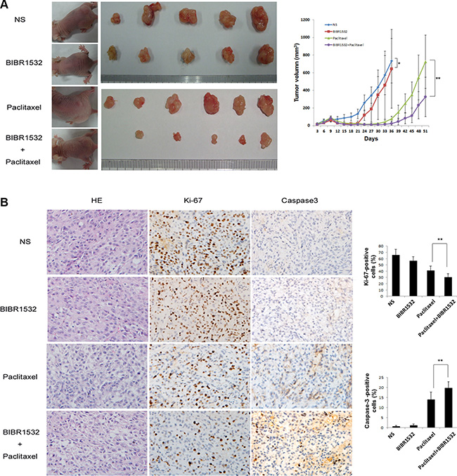 Telomerase inhibitor BIBR1532 prevents KrasG12D-Calu-3 xenograft tumor growth and increases the paclitaxel killing effect.