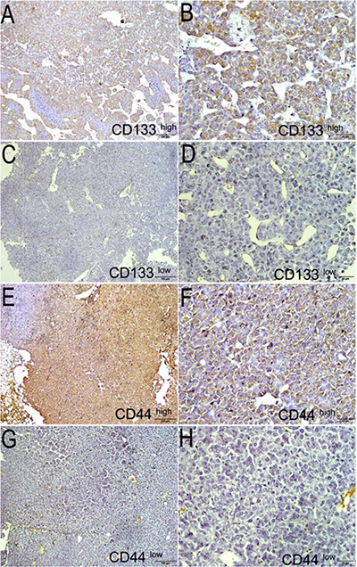 Expression of markers CD133 and CD44 in tumors using HE staining (left panel) and IHC (right panel) from PDX models.