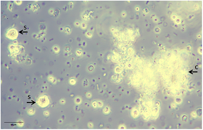 Non-adherent tumorspheres developed in suspension culture under stem cell-like growth conditions.