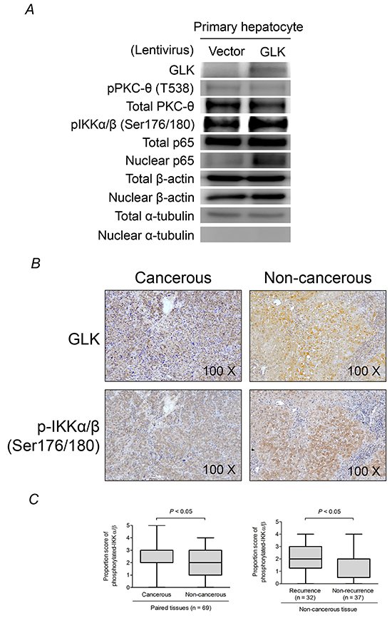 GLK induces PKC-&#x03B8;-independent activation of NF&#x03BA;B.