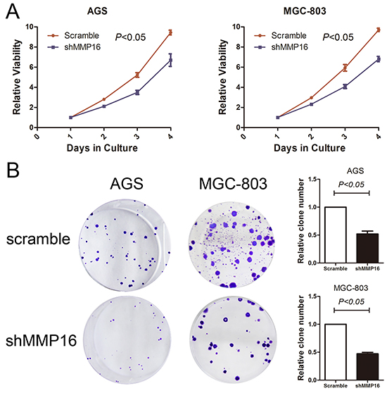 Silencing of MMP16 expression impaired gastric cancer cell viability determined by CCK8