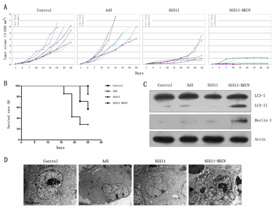 Antileukemic efficacy of SG511-BECN in established K562 tumors