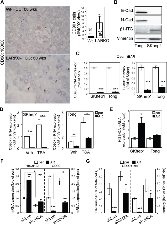 AR suppresses CD90 expression by upregulating Histone 3H2A.