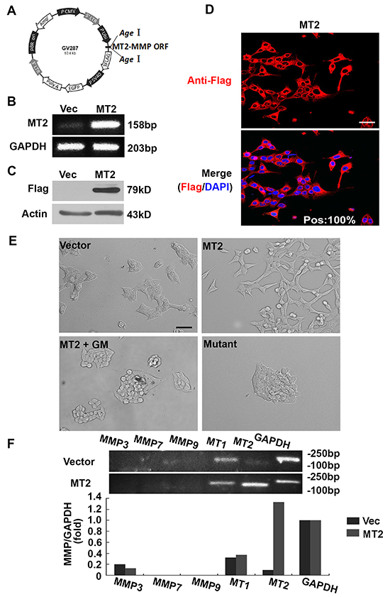 MT2-MMP stable expression in HCT116 cells results in EMT.