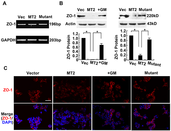 MT2-MMP decreases cellular tight junction ZO-1 expression.