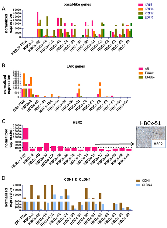 RT-PCR expression analysis of selected genes differentially expressed in molecular subtypes of TNBC.