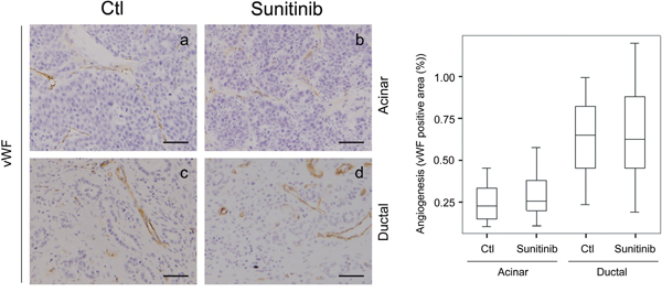 Sunitinib effects on Ela-myc pancreatic tumor angiogenesis.