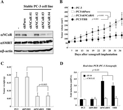 Effect of CK2-NCoR axis inhibition on