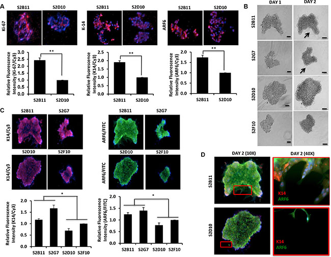 Overexpression of K14/ARF6 in aggressive CD49f+/CD44+/CD24&#x2212; single-cell derived clones.