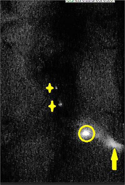 In the near-infrared fluorescence imaging, second echelon lymph nodes were found 20 minutes after injection with 50 &#x03BC;L and 100 &#x03BC;L.