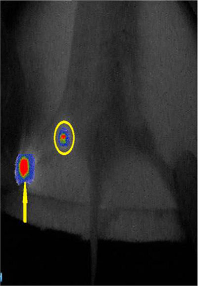 The fusion image of the near-infrared fluorescence and the cyclone storage phosphor system.