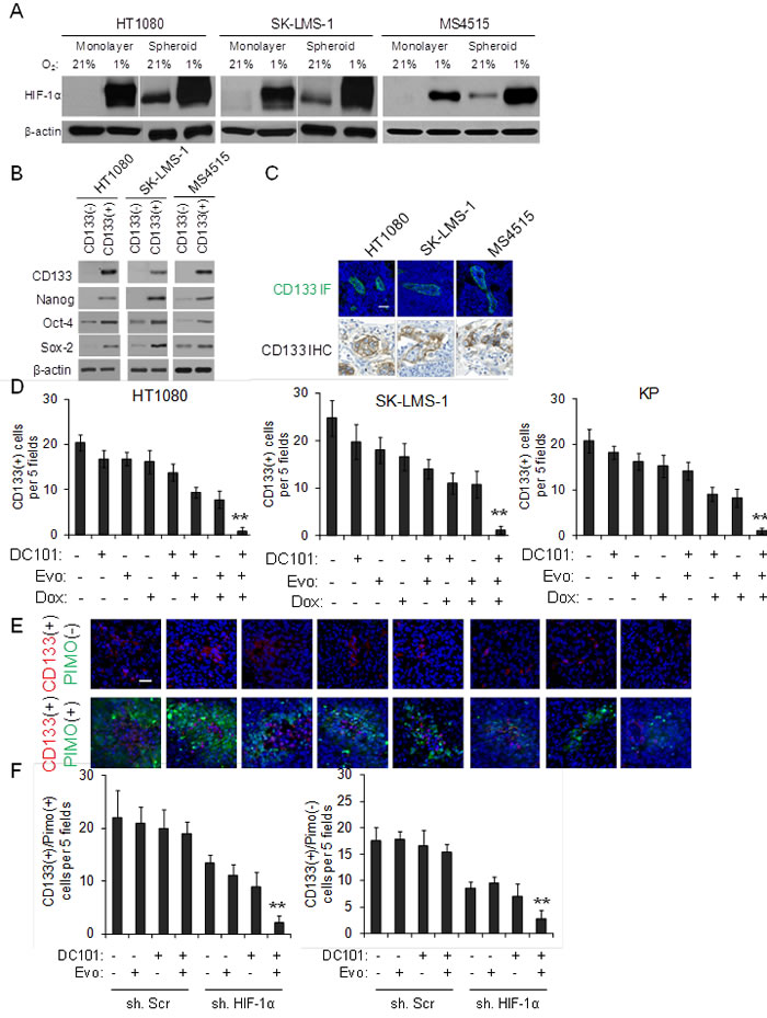 Effects of multimodal therapy on sarcoma cancer stem-like cells.