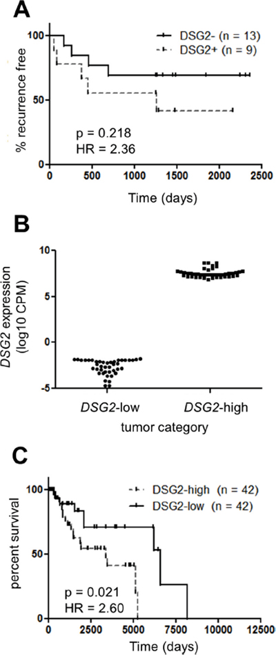 DSG2 over-expression in melanoma is associated with poor clinical outcome.