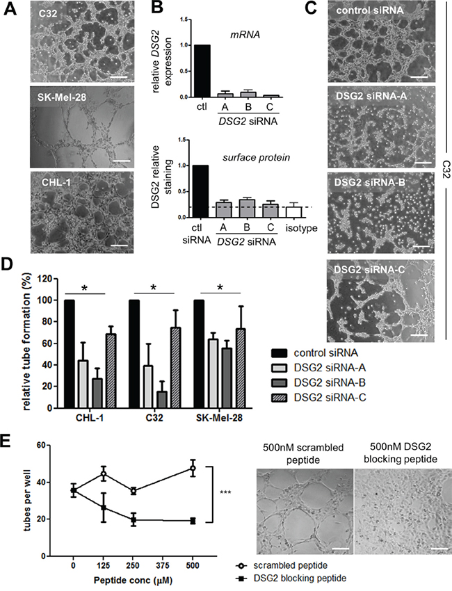 DSG2 regulates the formation of tube-like structures by melanoma cells on Matrigel.