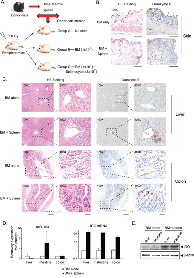 miR-153-3p expression is decreased while IDO expression is increased in murine recipients with aGVHD.