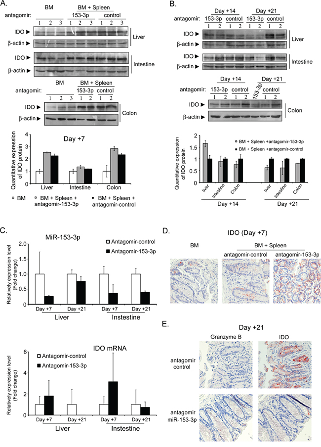 The miR-153-3p antagomir increases IDO expression at the early stage after allo-HSCT.