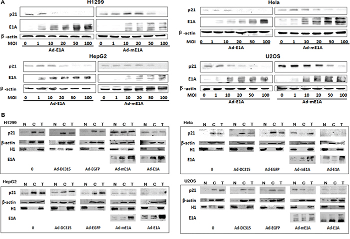 Ad-DC315-mE1A or Ad-DC315-E1A affected cellular p21 localization.