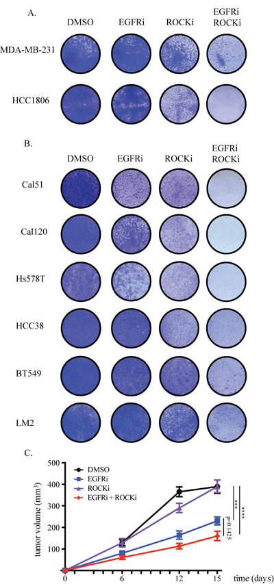 Combined EGFR and ROCK inhibition effectively blocks proliferation of TNBC cells.