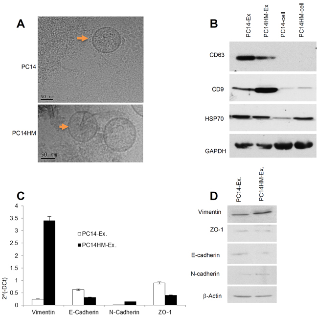 Characterization of exosomes derived from PC14 and PC14HM cells.