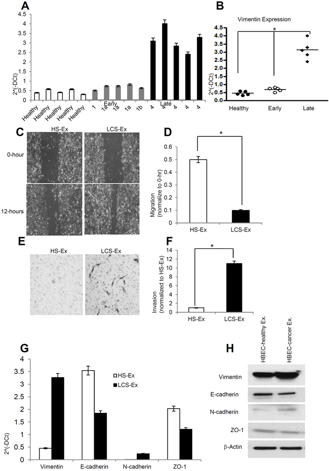 Late stage human lung cancer serum exosomes express higher vimentin and induce migration and invasion in recipient HBEC cells.
