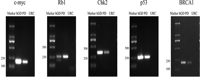 PCR detection of the target genes contained in each BAC clone, such as c-myc, Rb1, Chk2, p53 and BRCA1.