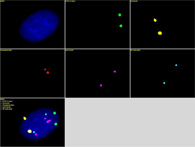 The mixture of the five FISH probes, Green-c-myc (green), PF555-P16 (yellow), PF590-Rb1 (red), HyPer5-CycD (purple), and PF415-p53 (blue) (Table 2), was hybridized with the human diploid fibroblasts.